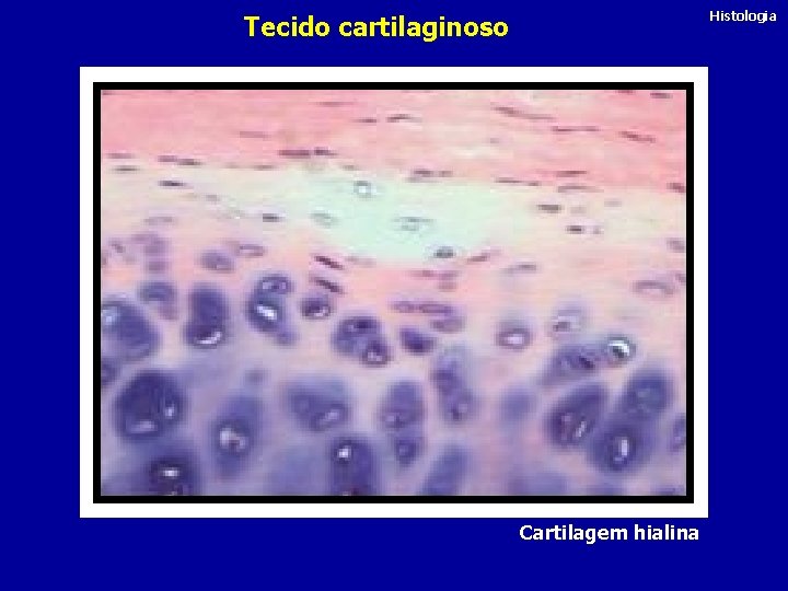 Histologia Tecido cartilaginoso Cartilagem hialina 