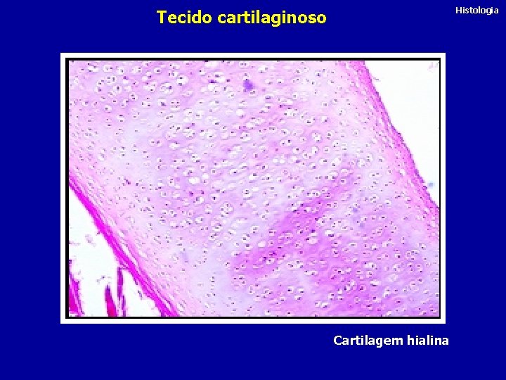Histologia Tecido cartilaginoso Cartilagem hialina 