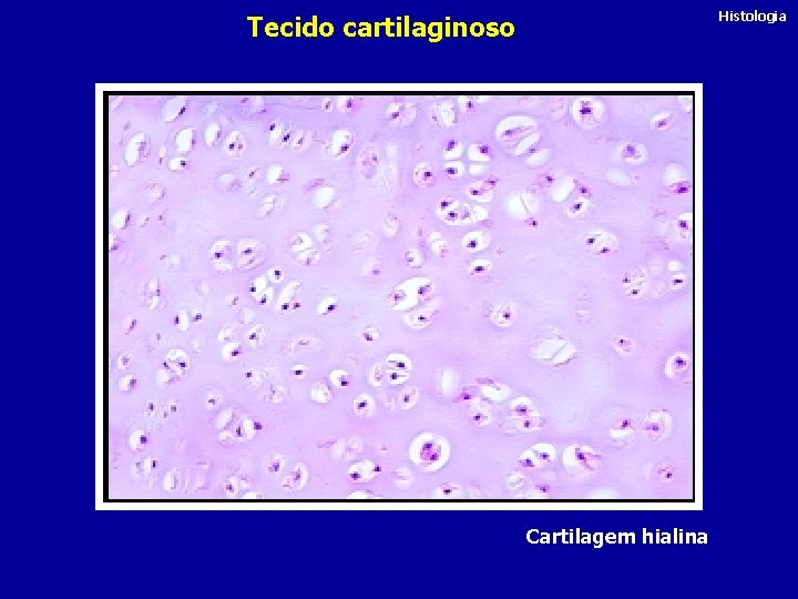 Histologia Tecido cartilaginoso Cartilagem hialina 