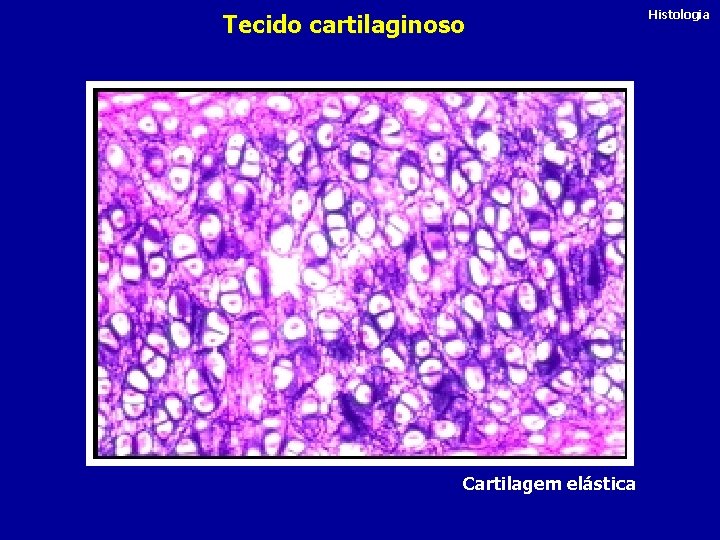 Tecido cartilaginoso Cartilagem elástica Histologia 