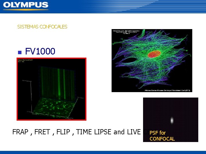 SISTEMAS CONFOCALES n FV 1000 FRAP , FRET , FLIP , TIME LIPSE and