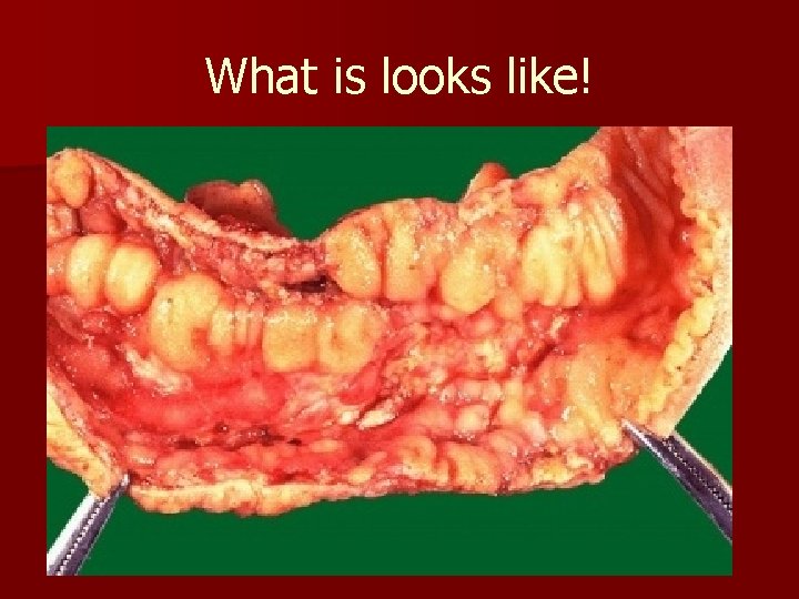 What is looks like! 
