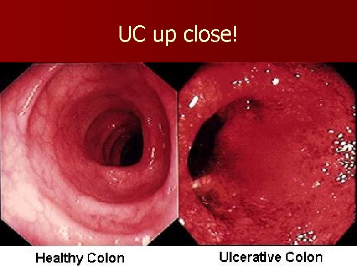 UC up close! 