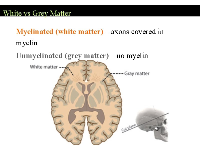White vs Grey Matter Myelinated (white matter) – axons covered in myelin Unmyelinated (grey