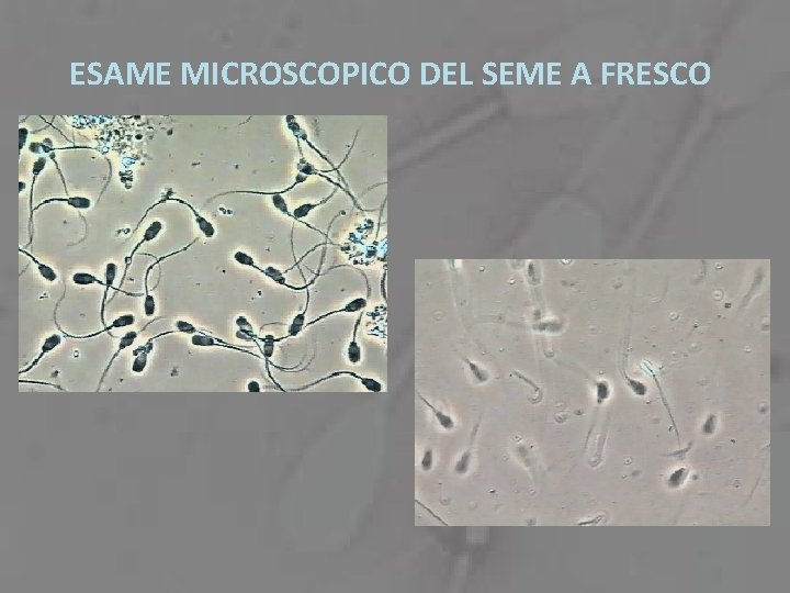 ESAME MICROSCOPICO DEL SEME A FRESCO 