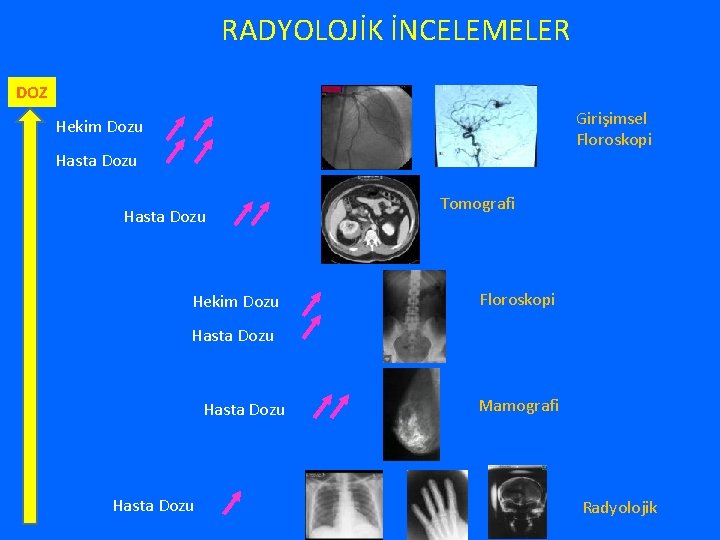 RADYOLOJİK İNCELEMELER DOZ Girişimsel Floroskopi Hekim Dozu Hasta Dozu Hekim Dozu Tomografi Floroskopi Hasta