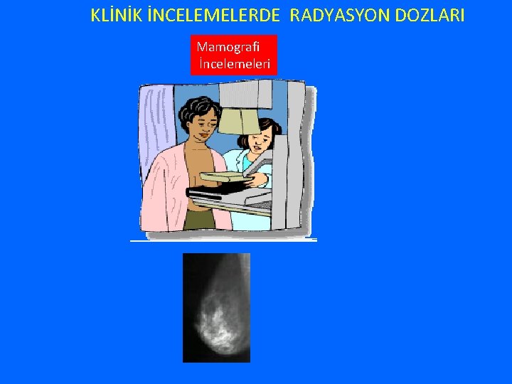 KLİNİK İNCELEMELERDE RADYASYON DOZLARI Mamografi İncelemeleri 