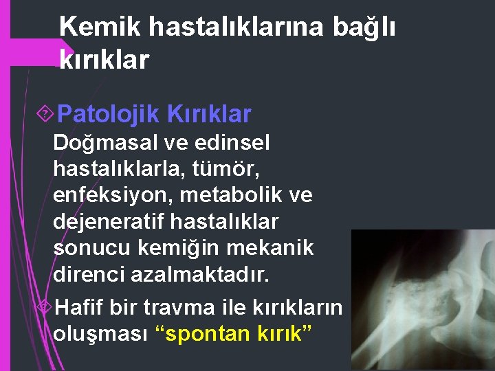 Kemik hastalıklarına bağlı kırıklar Patolojik Kırıklar Doğmasal ve edinsel hastalıklarla, tümör, enfeksiyon, metabolik ve