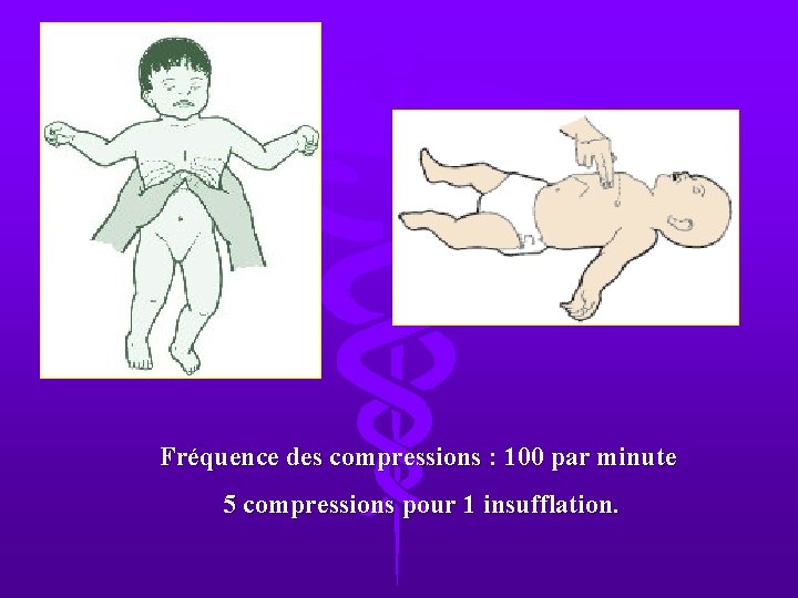 Fréquence des compressions : 100 par minute 5 compressions pour 1 insufflation. 