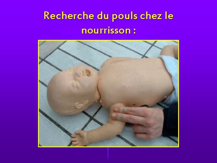 Recherche du pouls chez le nourrisson : 