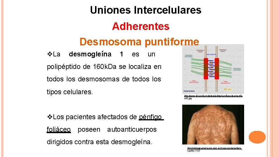 Uniones Intercelulares Adherentes Desmosoma puntiforme La desmogleína 1 es un polipéptido de 160 k.
