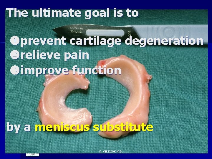 The ultimate goal is to prevent cartilage degeneration relieve pain improve function by a