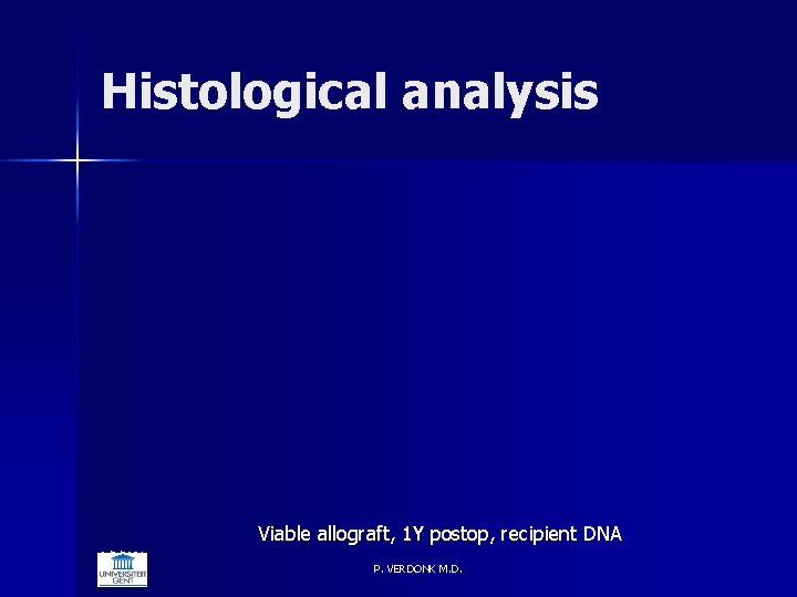 Histological analysis Viable allograft, 1 Y postop, recipient DNA 6/5/2021 P. VERDONK M. D.