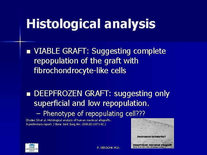 Histological analysis n VIABLE GRAFT: Suggesting complete repopulation of the graft with fibrochondrocyte-like cells