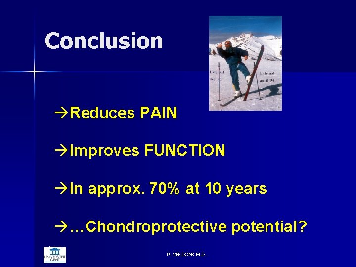 Conclusion Reduces PAIN Improves FUNCTION In approx. 70% at 10 years …Chondroprotective potential? 6/5/2021