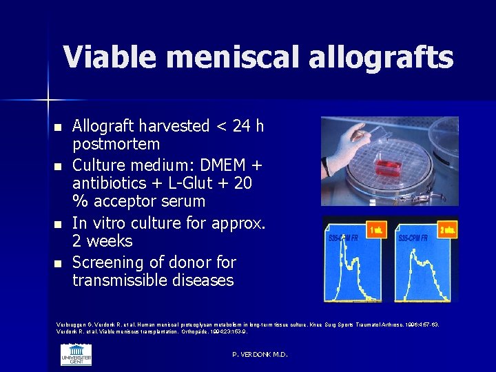 Viable meniscal allografts n n Allograft harvested < 24 h postmortem Culture medium: DMEM