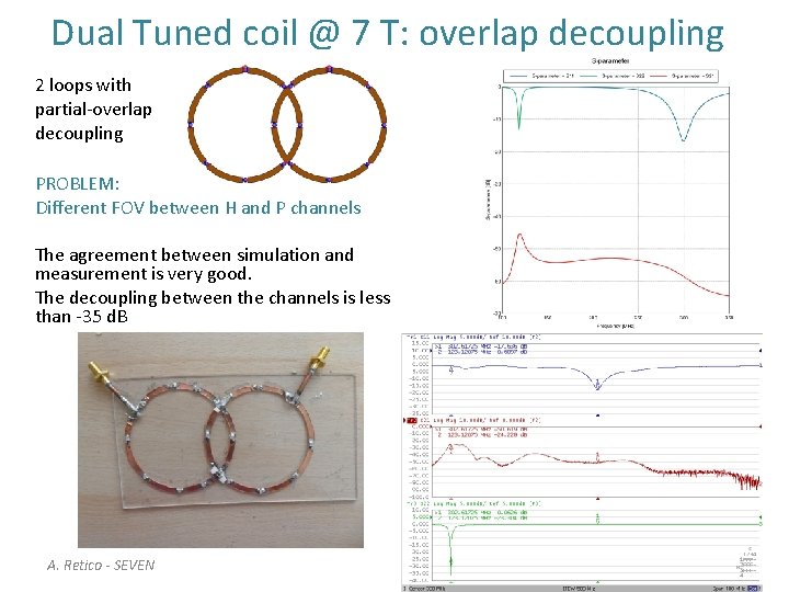 Dual Tuned coil @ 7 T: overlap decoupling 2 loops with partial-overlap decoupling PROBLEM: