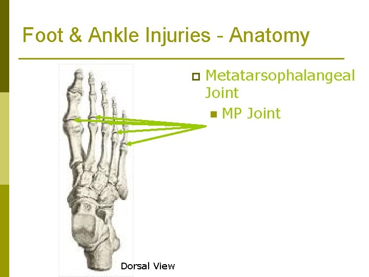 Foot & Ankle Injuries - Anatomy p Dorsal View Metatarsophalangeal Joint n MP Joint