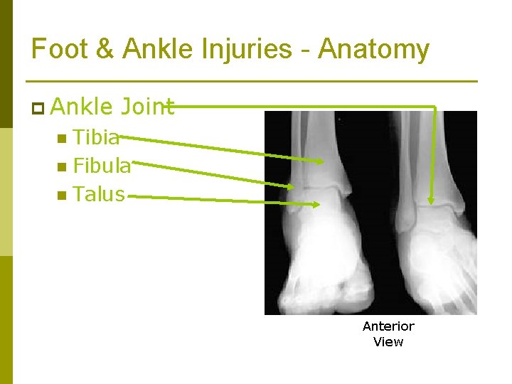 Foot & Ankle Injuries - Anatomy p Ankle Joint Tibia n Fibula n Talus