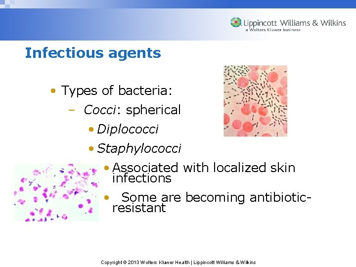 Infectious agents • Types of bacteria: – Cocci: spherical • Diplococci • Staphylococci •