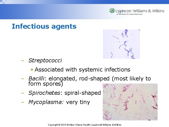 Infectious agents – Streptococci • Associated with systemic infections – Bacilli: elongated, rod-shaped (most