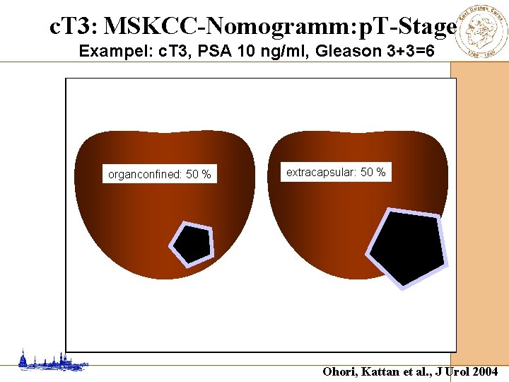 c. T 3: MSKCC-Nomogramm: p. T-Stage Exampel: c. T 3, PSA 10 ng/ml, Gleason