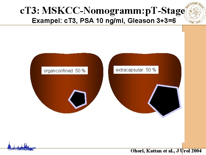 c. T 3: MSKCC-Nomogramm: p. T-Stage Exampel: c. T 3, PSA 10 ng/ml, Gleason