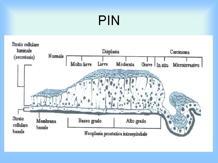 PIN 