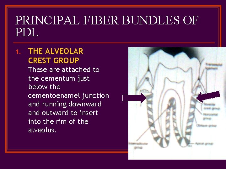 PRINCIPAL FIBER BUNDLES OF PDL 1. THE ALVEOLAR CREST GROUP These are attached to