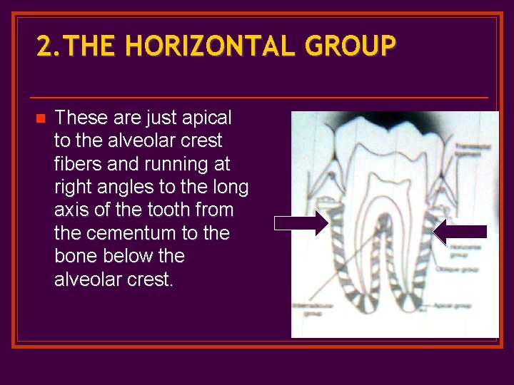 2. THE HORIZONTAL GROUP n These are just apical to the alveolar crest fibers