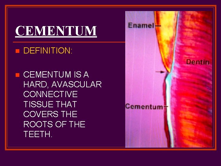CEMENTUM n DEFINITION: n CEMENTUM IS A HARD, AVASCULAR CONNECTIVE TISSUE THAT COVERS THE