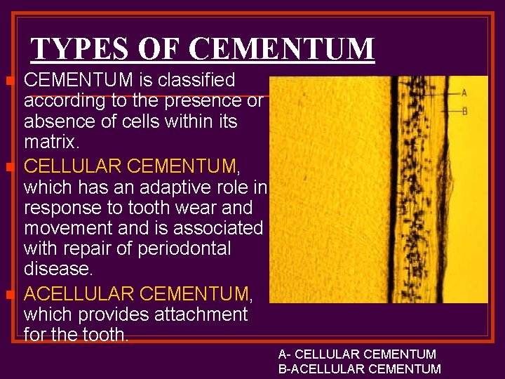 TYPES OF CEMENTUM n n n CEMENTUM is classified according to the presence or