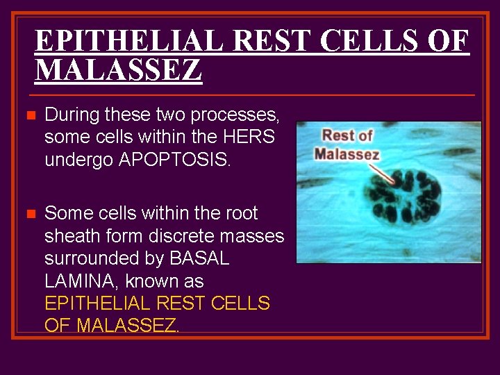 EPITHELIAL REST CELLS OF MALASSEZ n During these two processes, some cells within the