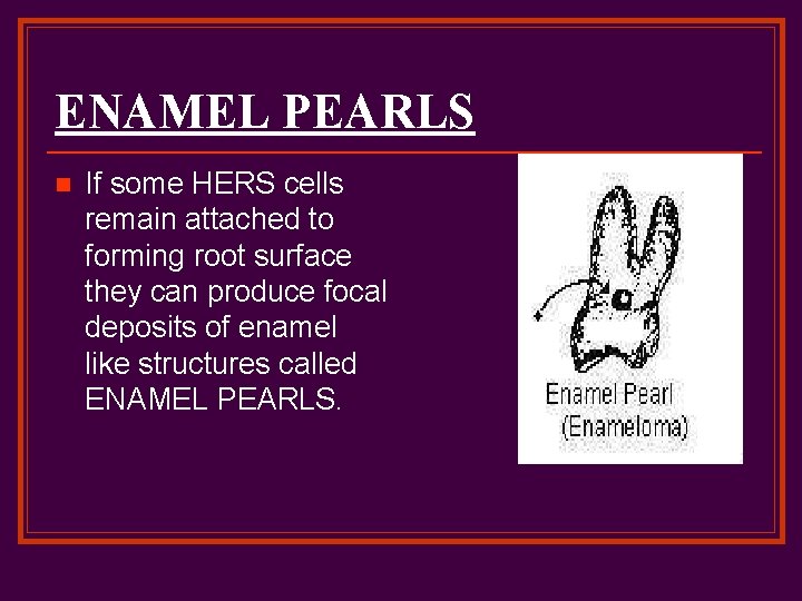 ENAMEL PEARLS n If some HERS cells remain attached to forming root surface they