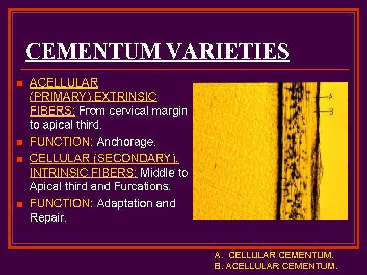 CEMENTUM VARIETIES n n ACELLULAR (PRIMARY). EXTRINSIC FIBERS: From cervical margin to apical third.