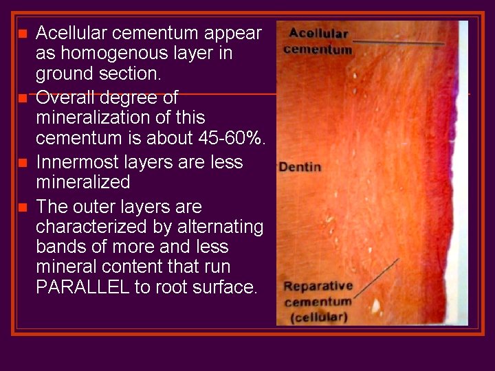 n n Acellular cementum appear as homogenous layer in ground section. Overall degree of