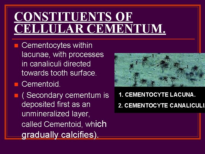 CONSTITUENTS OF CELLULAR CEMENTUM. n n n Cementocytes within lacunae, with processes in canaliculi