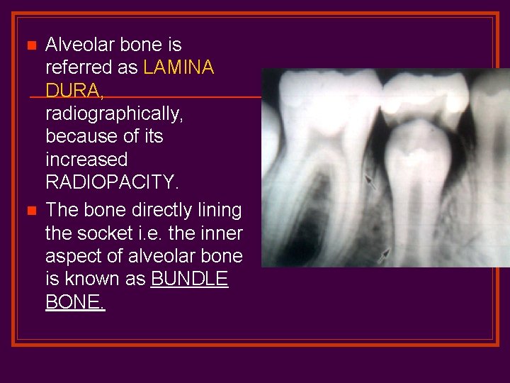 n n Alveolar bone is referred as LAMINA DURA, radiographically, because of its increased