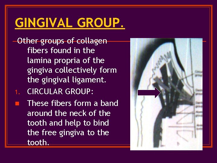 GINGIVAL GROUP. Other groups of collagen fibers found in the lamina propria of the