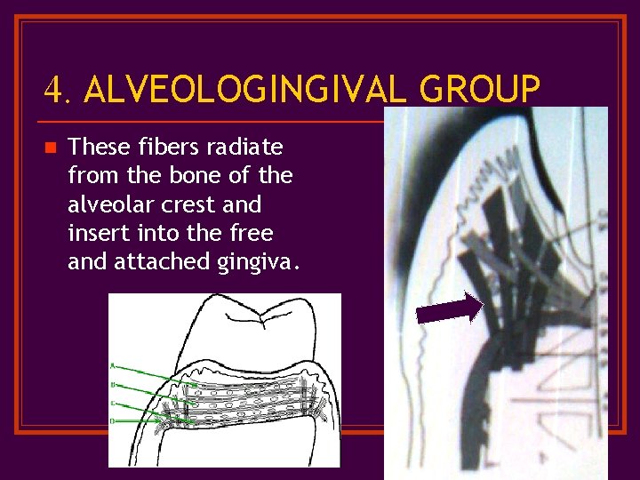 4. ALVEOLOGINGIVAL GROUP n These fibers radiate from the bone of the alveolar crest