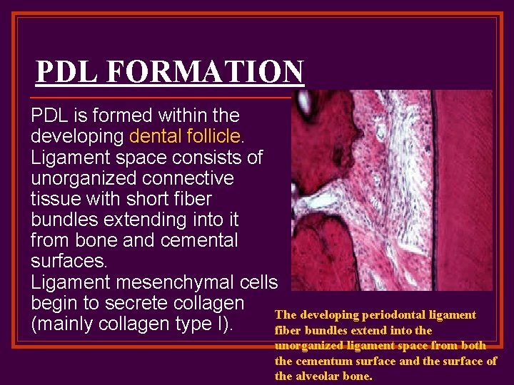 PDL FORMATION PDL is formed within the developing dental follicle. Ligament space consists of