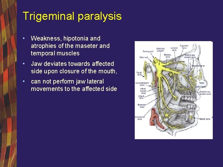 Trigeminal paralysis • Weakness, hipotonia and atrophies of the maseter and temporal muscles •
