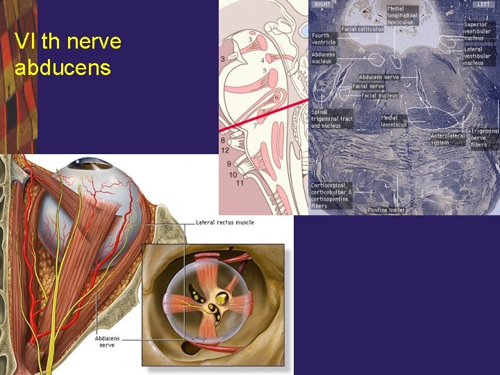 VI th nerve abducens 