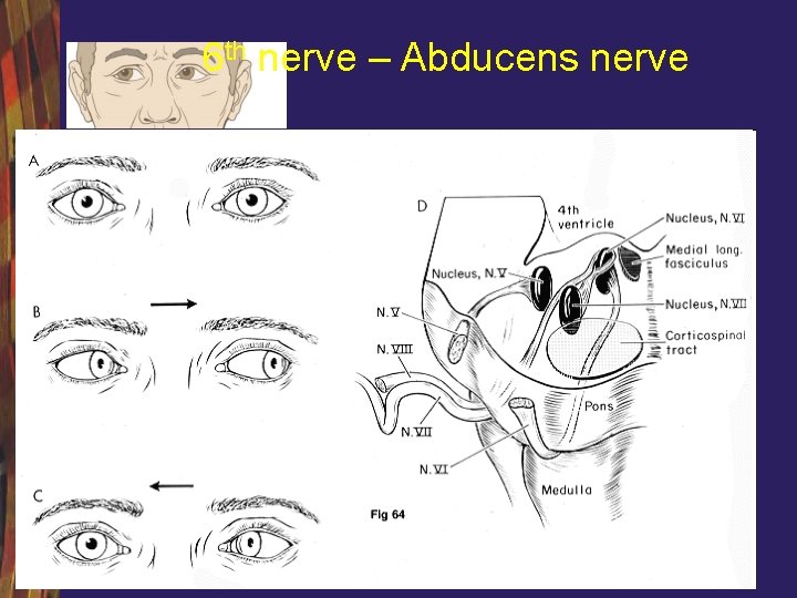 6 th nerve – Abducens nerve 