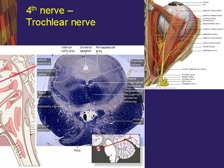 4 th nerve – Trochlear nerve 