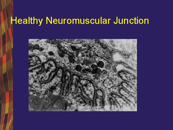 Healthy Neuromuscular Junction 