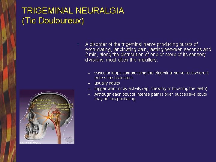 TRIGEMINAL NEURALGIA (Tic Douloureux) • A disorder of the trigeminal nerve producing bursts of