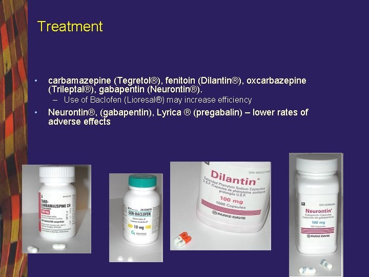 Treatment • carbamazepine (Tegretol®), fenitoin (Dilantin®), oxcarbazepine (Trileptal®), gabapentin (Neurontin®). – Use of Baclofen