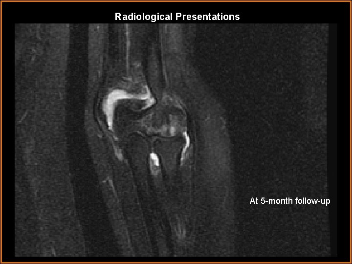 Radiological Presentations At 5 -month follow-up 