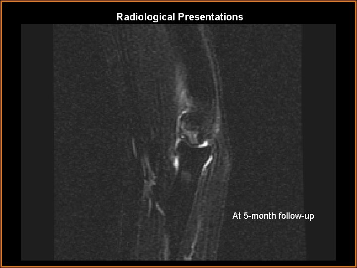 Radiological Presentations At 5 -month follow-up 